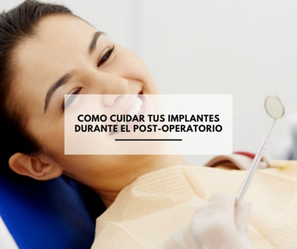 Como cuidar tus implantes durante el post-operatorio