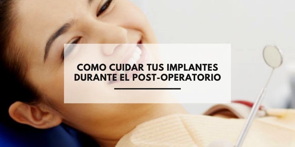 Como cuidar tus implantes durante el post-operatorio Como cuidar tus implantes durante el post-operatorio