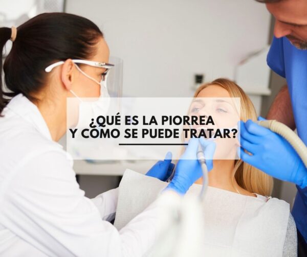 piorrea piorrea