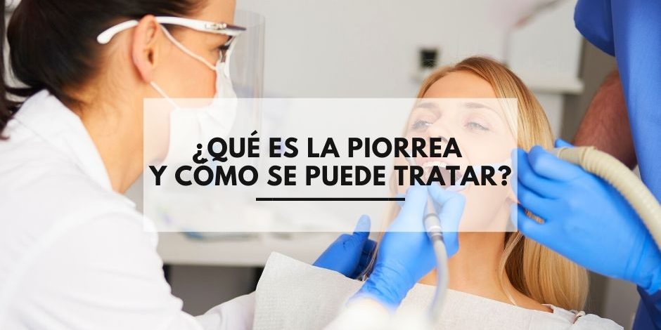 piorrea piorrea