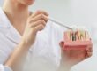 partes de un implante dental
