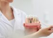 partes de un implante dental