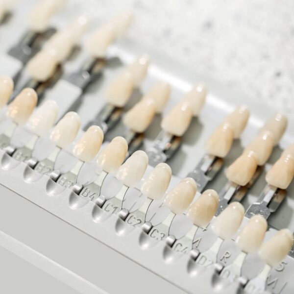 implantes dentales