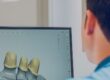 implantes dentales guiada por ordenador