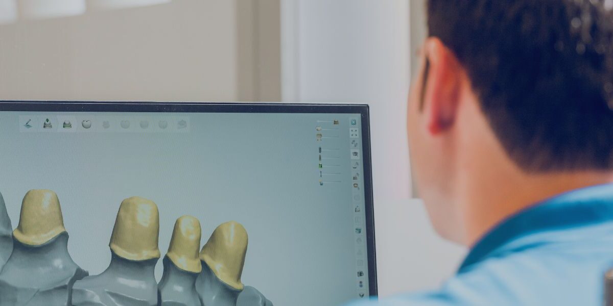 implantes dentales guiada por ordenador implantes dentales guiada por ordenador