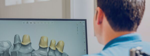 implantes dentales guiada por ordenador