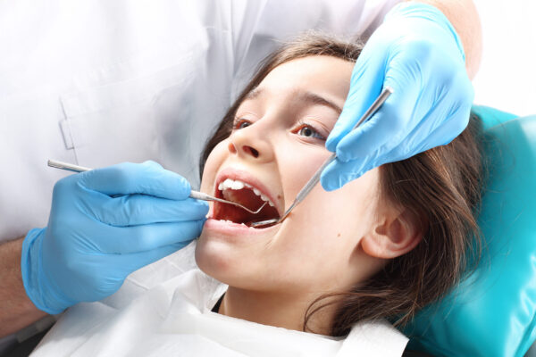 selladores dentales en niños