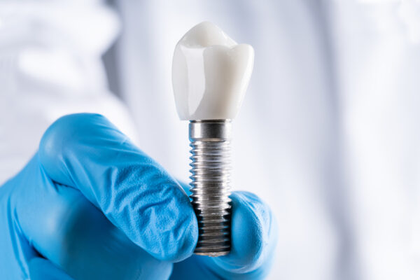 Implantes inmediatos vs. implantes diferidos
